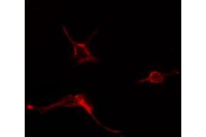 ABIN6274580 staining COLO205 cells by IF/ICC. (ADCY6 抗体  (Internal Region))