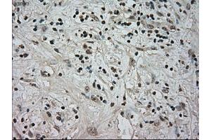 Image no. 4 for anti-Neurotrophic tyrosine Kinase, Receptor, Type 3 (NTRK3) antibody (ABIN1499842)