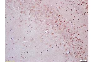 Immunohistochemistry (IHC) image for anti-POU Domain, Class 2, Transcription Factor 1 (POU2F1) (C-Term) antibody (ABIN737286)
