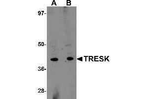 Western Blotting (WB) image for anti-Potassium Channel Subfamily K Member 18 (KCNK18) (Middle Region) antibody (ABIN1031143) (KCNK18 抗体  (Middle Region))