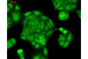 Immunocytochemistry/Immunofluorescence analysis using Rabbit Anti-Rab4 Polyclonal Antibody (ABIN361840 and ABIN361841).