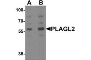 Western blot analysis of PLAGL2 in rat brain tissue lysate with PLAGL2 Antibody  at (A) 1 and (B) 2 ug/ml. (PLAGL2 抗体  (N-Term))