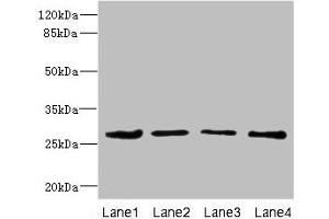 Western blot All lanes: DCXR antibody at 2. (DCXR 抗体  (AA 1-244))