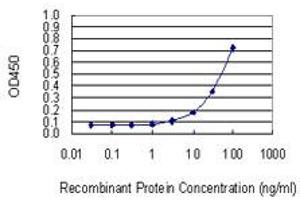 Detection limit for recombinant GST tagged UCK2 is 1 ng/ml as a capture antibody. (UCK2 抗体  (AA 1-261))