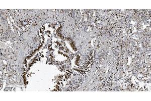 IHC analysis of SAMHD1 using anti-SAMHD1 antibody (ABIN7601514).
