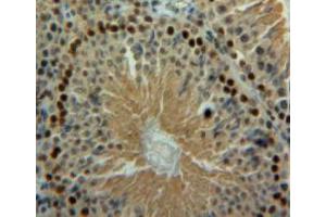 Used in DAB staining on fromalin fixed paraffin-embedded testis tissue (BLMH 抗体  (AA 30-165))