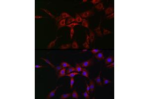 Immunofluorescence analysis of NIH/3T3 cells using  Rabbit pAb (ABIN7265789) at dilution of 1:50 (40x lens). (ATG12 抗体  (AA 1-74))