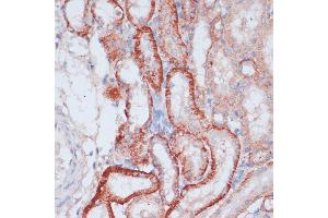 Immunohistochemistry of paraffin-embedded rat kidney using RPL31 antibody (ABIN7270002) at dilution of 1:100 (40x lens). (RPL31 抗体  (AA 5-105))
