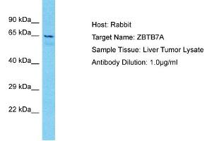 Host: Rabbit Target Name: ZBTB7A Sample Type: Liver Tumor lysates Antibody Dilution: 1. (ZBTB7A 抗体  (N-Term))