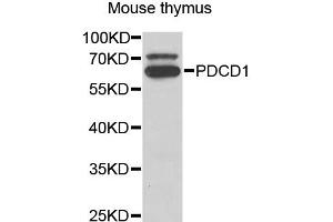 Western blot analysis of extracts of mouse thymus, using PDCD1 antibody (ABIN5973254) at 1/1000 dilution. (PD-1 抗体)
