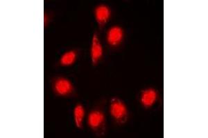 Immunofluorescent analysis of DPF2 staining in Jurkat cells. (DPF2 抗体)