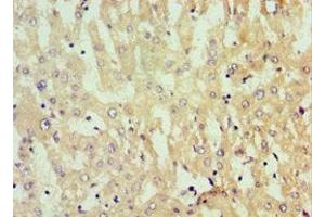 Immunohistochemistry of paraffin-embedded human liver tissue using ABIN7154755 at dilution of 1:100 (Nucleostemin 抗体  (AA 1-240))