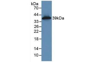 WB of Protein Standard: different control antibodies against Highly purified E. (KRT16 ELISA 试剂盒)