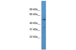 WB Suggested Anti-CYP24A1 Antibody Titration: 0. (CYP24A1 抗体  (C-Term))