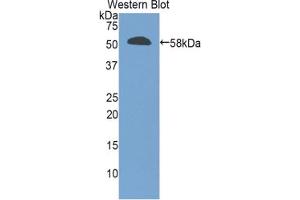 Western blot analysis of the recombinant protein. (GZMM 抗体  (AA 19-251))