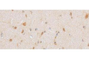 Immunohistochemistry of paraffin-embedded Mouse brain using TRIP4 Polyclonal Antibody at dilution of 1:50 (TRIP4 抗体)