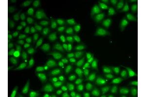 Immunofluorescence analysis of A549 cells using FEN1 antibody (ABIN5970521). (FEN1 抗体)