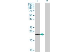 Western Blot analysis of FTL expression in transfected 293T cell line by FTL MaxPab polyclonal antibody.