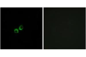 Immunofluorescence analysis of MCF7 cells, using TAS1R3 Antibody. (TAS1R3 抗体  (AA 326-375))