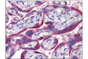 Human Placenta: Formalin-Fixed, Paraffin-Embedded (FFPE) (PAPPA2 抗体  (N-Term))