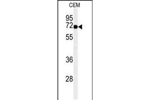 Western blot analysis of MFSD6 Antibody in CEM cell line lysates (35ug/lane)