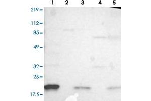 Western blot analysis of Lane 1: RT-4, Lane 2: U-251 MG, Lane 3: A-431, Lane 4: Liver, Lane 5: Tonsil with IL1RN polyclonal antibody .