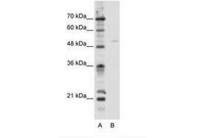 Image no. 1 for anti-Transcription Factor EB (TFEB) (C-Term) antibody (ABIN202620) (TFEB 抗体  (C-Term))
