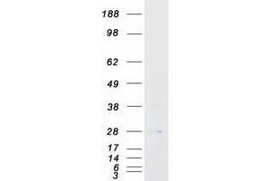 Western Blotting (WB) image for A Kinase (PRKA) Interacting Protein 1 (AKIP1) (Transcript Variant 2) protein (Myc-DYKDDDDK Tag) (ABIN2715170)
