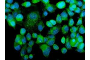 IF analysis of MEKK2/MAP3K2 using anti-MEKK2/MAP3K2 antibody (ABIN7599314).