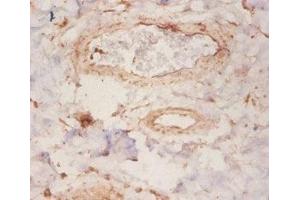 Immunohistochemistry of paraffin-embedded human mammary gland tissue using ABIN7167903 at dilution of 1:50 (ARHGDIA 抗体  (AA 2-204))