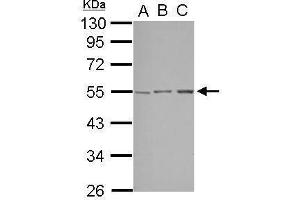 WB Image Sample (30 ug of whole cell lysate) A: A549 B: HepG2 C: HCT116 10% SDS PAGE antibody diluted at 1:1000 (STK38L 抗体)