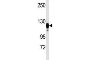 Western blot analysis of EGF Receptor antibody and kidney heart tissue lysate (EGFR 抗体  (AA 1048-1077))