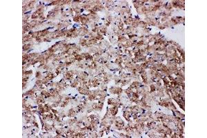IHC-P: GLUT4 antibody testing of rat heart tissue (GLUT4 抗体  (AA 491-509))