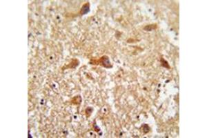 Immunohistochemistry (Paraffin-embedded Sections) (IHC (p)) image for anti-Phosphatidylinositol Glycan Anchor Biosynthesis, Class X (PIGX) (AA 74-103), (N-Term) antibody (ABIN954141)
