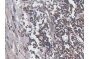 DAB staining on IHC-P; Samples: Human Lymph node Tissue (Perforin 1 抗体  (AA 32-316))