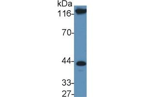 Detection of IL11Ra in Rat Serum using Polyclonal Antibody to Interleukin 11 Receptor Alpha (IL11Ra) (IL11RA 抗体  (AA 194-329))