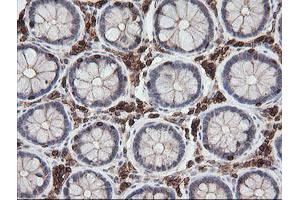 Image no. 3 for anti-Differentially Expressed in FDCP 6 Homolog (DEF6) antibody (ABIN1497808)