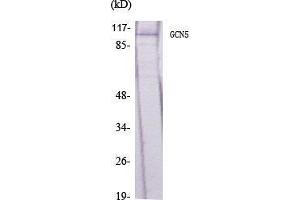 Western Blot (WB) analysis of specific cells using GCN5 Polyclonal Antibody. (KAT2A 抗体  (C-Term))