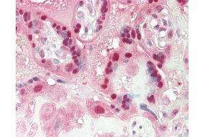 Immunohistochemistry (IHC) image for anti-Protein Phosphatase 1, Regulatory Subunit 13 Like (PPP1R13L) (AA 501-550) antibody (ABIN6755410)