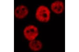 ABIN6277019 staining  Hela cells by IF/ICC. (RPS19 抗体  (Internal Region))