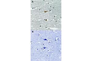 Immunohistochemical staining of human brain tissue by STK39 (phospho S309) polyclonal antibody  without blocking peptide (A) or preincubated with blocking peptide (B). (STK39 抗体  (pSer309))