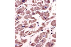 (ABIN391346 and ABIN2841367) staining SPHK1 in human heart tissue sections by Immunohistochemistry (IHC-P - paraformaldehyde-fixed, paraffin-embedded sections). (SPHK1 抗体  (AA 286-315))