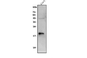 Western blot analysis of Claudin 3/CLDN3 using anti-Claudin 3/CLDN3 antibody (ABIN7602816).