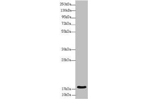 Western blot All lanes: RNF5 antibody at 3. (RNF5 抗体  (AA 1-120))
