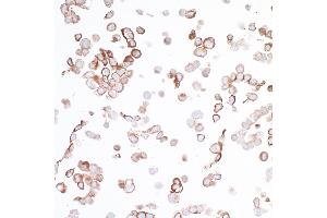 anti-V-Set Domain Containing T Cell Activation Inhibitor 1 (VTCN1) (AA 30-282) antibody