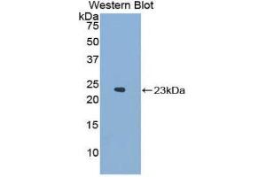 Western Blotting (WB) image for anti-Neutrophil Cytosolic Factor 2 (NCF2) (AA 354-525) antibody (ABIN1859970)