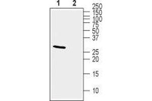 Western blot analysis of mouse brain lysate: - 1. (KCNIP2 抗体  (Cytosolic))