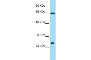 Host: Rabbit Target Name: GSTCD Sample Type: Hela Whole cell lysates Antibody Dilution: 1. (GSTCD 抗体  (N-Term))