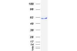 Western Blotting (WB) image for Butyrophilin, Subfamily 1, Member A1 (BTN1A1) protein (Myc-DYKDDDDK Tag) (ABIN2715352)