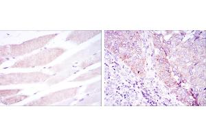 Immunohistochemical analysis of paraffin-embedded muscle tissues (left) and kidney cancer tissues (right) using BMPR2 mouse mAb with DAB staining. (BMPR2 抗体)